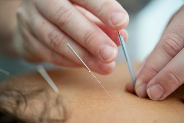 Fysiotherapie Hilversum Seinhorst: Jouw Partner voor Optimaal Herstel en Beweging!